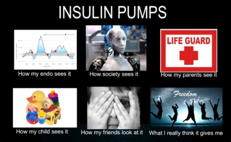 insulin-pumps